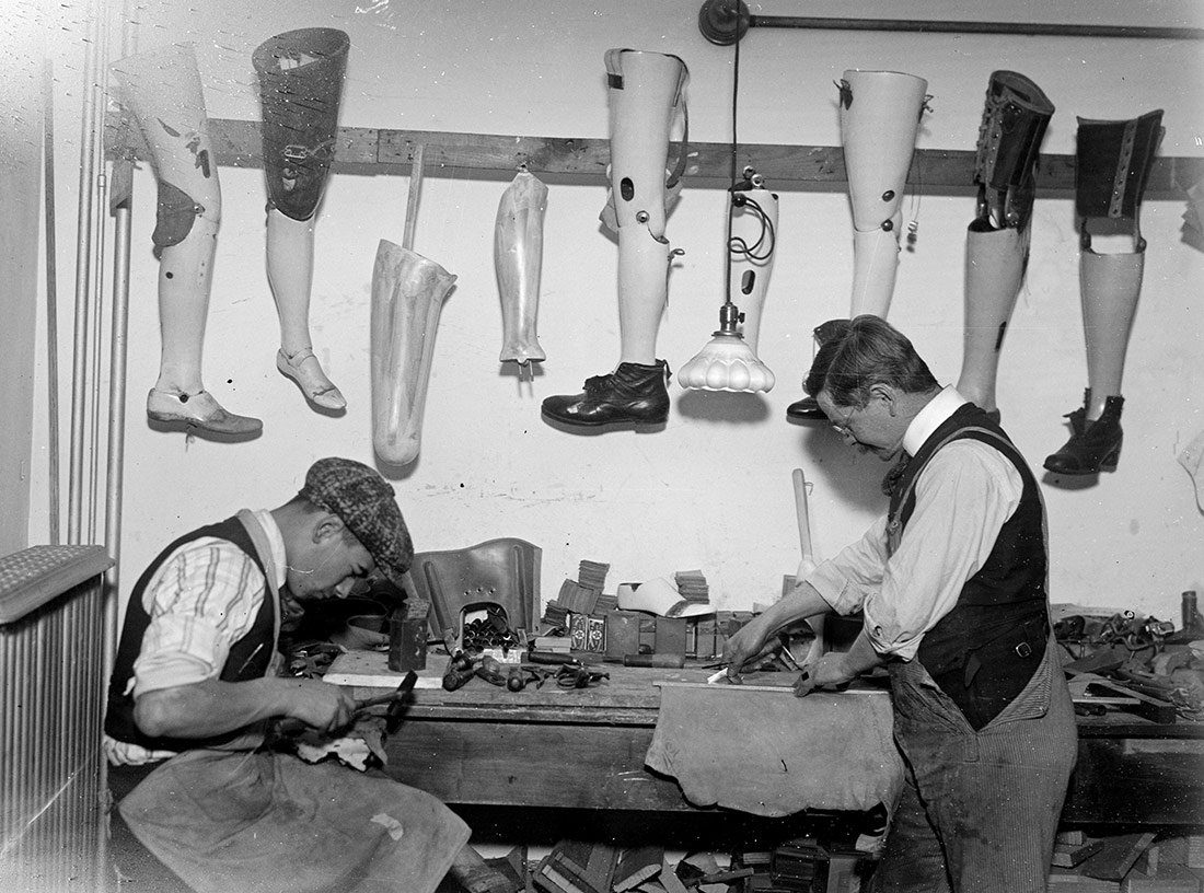Covering artificial leg, ca. 1920 | George Grantham Bain Collection (Library of Congress) | No known copyright restrictions
